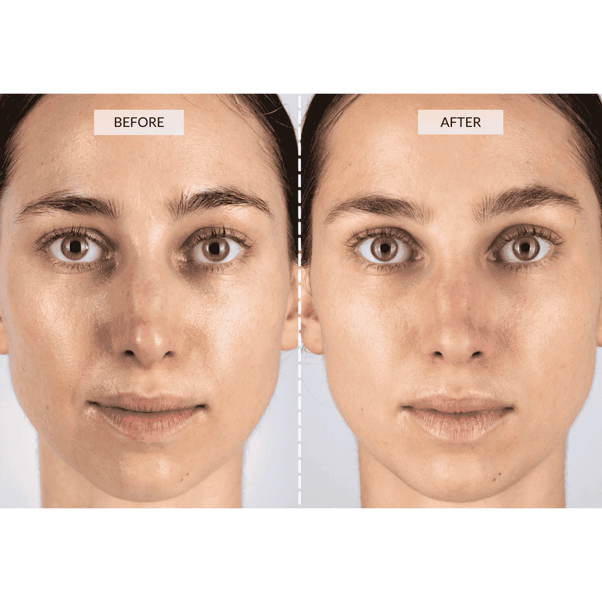 CurrentBody Skin LED 4-in-1 Face & Neck Kit (Worth $889) - Image 6