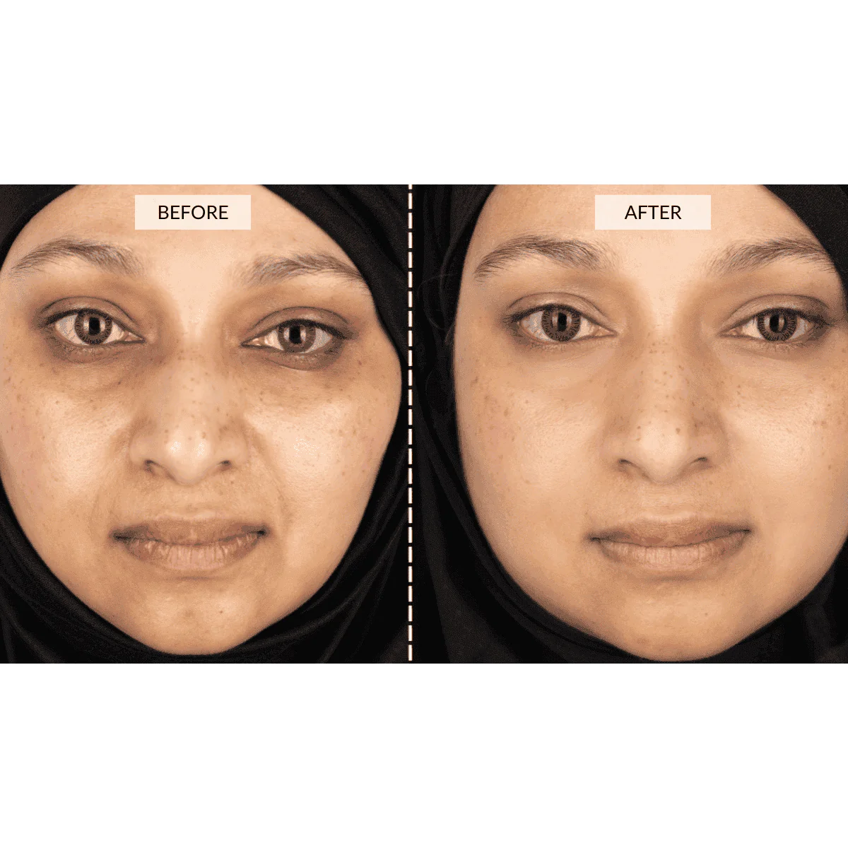 CurrentBody Skin LED 4-in-1 Face & Neck Kit (Worth $889) - Image 7