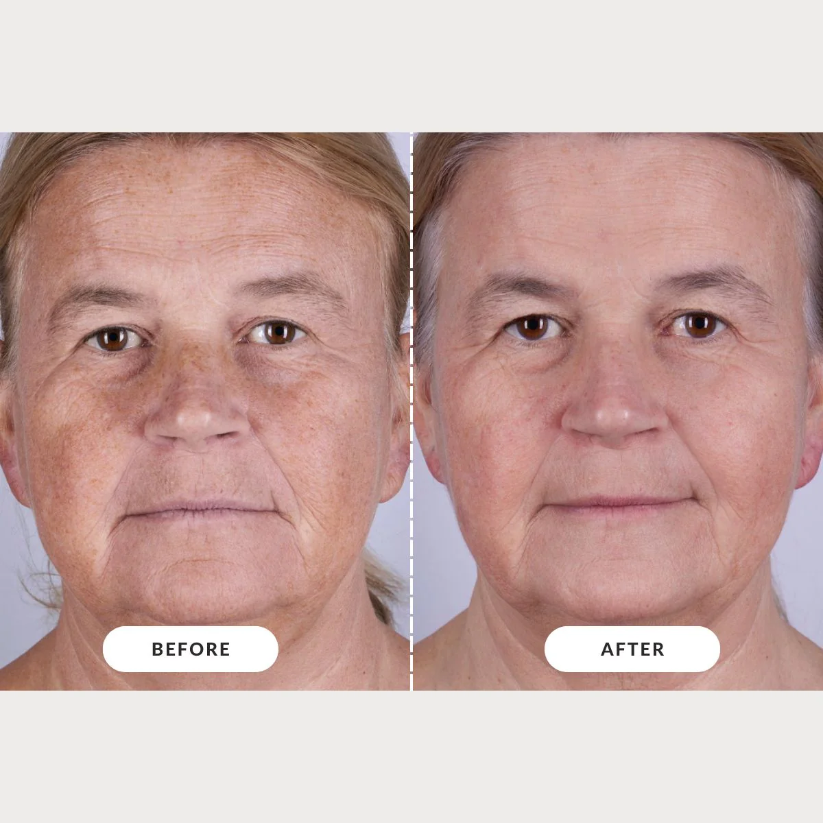 CurrentBody Skin LED Series 2 Face & Neck Kit - Black Friday Offer - Image 4