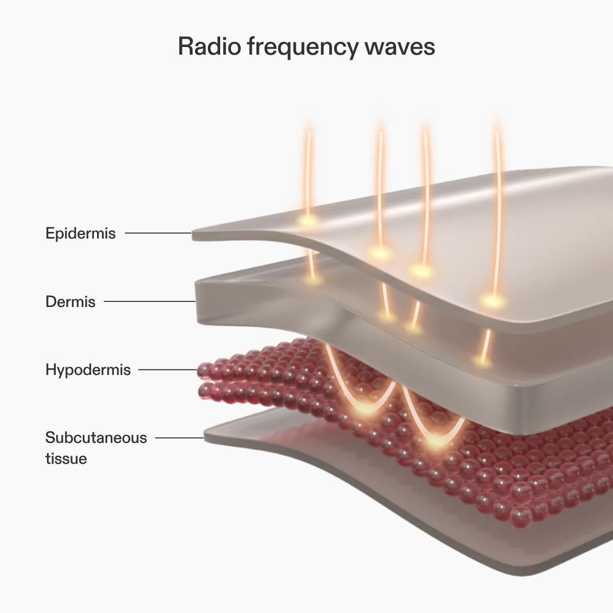 CurrentBody Skin RF Radio Frequency Skin Tightening Device - Image 3