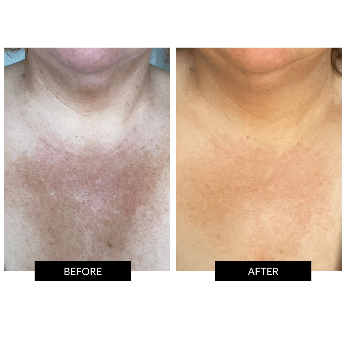 CurrentBody Ultimate Neck Care Kit - Image 3