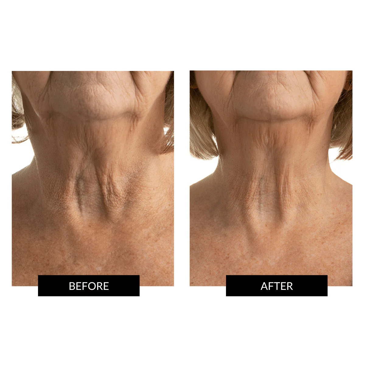 CurrentBody Ultimate Neck Care Kit - Image 4